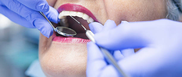 Best Emergency Treatment for Dental Infections or Abscesses in West Cape May, NJ